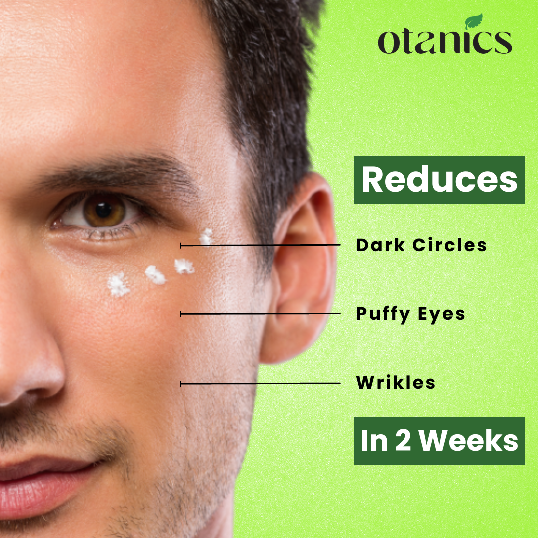 How To Get Rid Of Puffy Eyes & Dark Circles